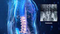 create 3d medical animation, medical explainer, surgery