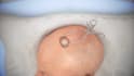create realistic 3d medical animations 3d neurosurgery brain anatomy animation