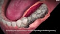 do 3d dental animation, 3d medical animation, surgery animation and 3d animation
