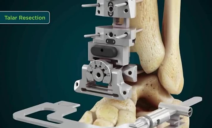 create 3d orthopedic implant medical device animation