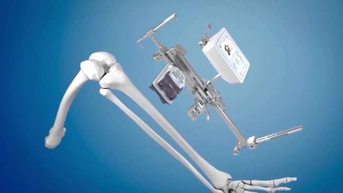 do 3d medical device animation 3d surgical device animation 3d orthopedic video