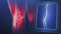 do 3d medical product animation 3d medical device 3d surgical anatomy scientific