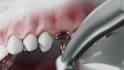 do 3d medical animation 3d surgery animation 3d explainer video