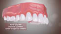 create well explanatory and realistic 3d medical animation video, dental video