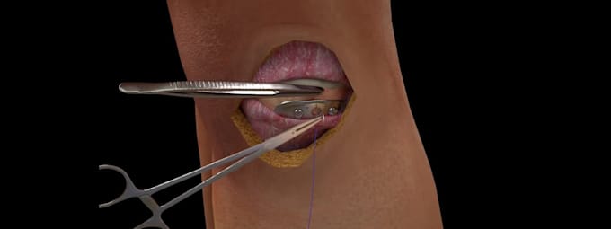 create medical animation video