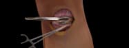 create medical animation video