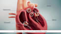 create 3d medical animation cardiovascular tavr heart aortic valve visualization