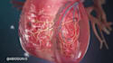 create realistic 3d medical animation, 3d animation and 3d medical device video