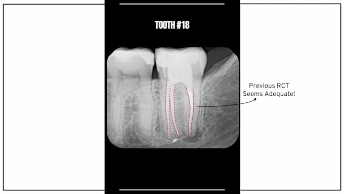 create for you a professional dental case presentation