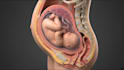 create ai 3d medical animation, anatomy explainer surgical video
