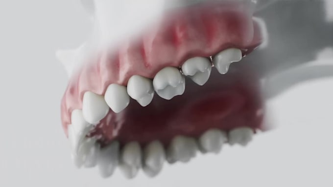 do 3d dental animation, 3d implant animation, 3d surgery animation, 3d medical
