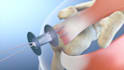 create scientifically accurate 3d medical animation