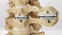 create 3d medical device animation and product visualization