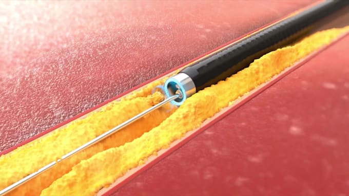 create professional 3d medical animation