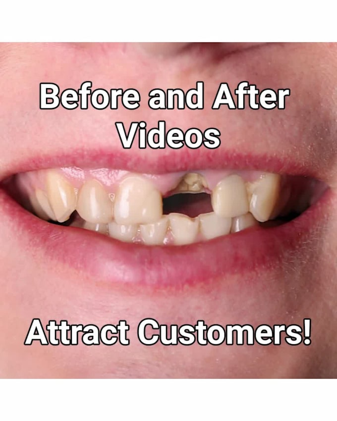 create a before and after video