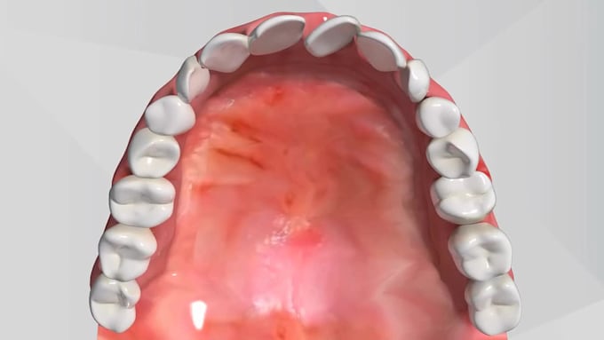 create realistic 3d medical animation, 3d dental explainer teeth procedures