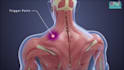 do 3d medical animation