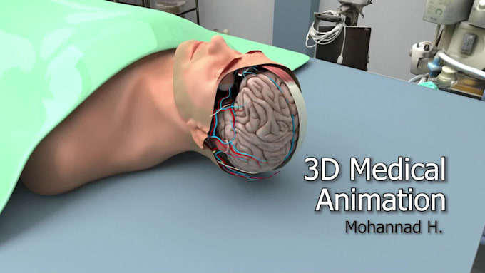 create 3d animation video for medical projects