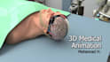 create 3d animation video for medical projects