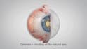create 3d medical animation, 3d surgical animation, medical explainer video