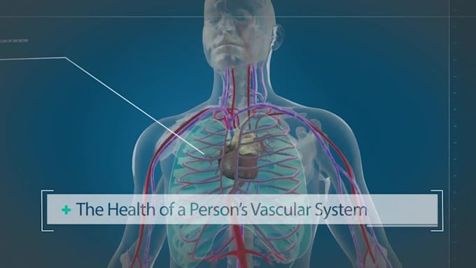 medical animation, 3d medical device explainer, surgery animation, anatomy video