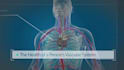 medical animation, 3d medical device explainer, surgery animation, anatomy video