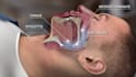 create 3d medical device animation, surgical procedure and orthopedic animation