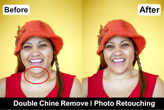 professionally slim body, reduce double chin, and reshape face