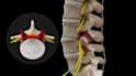 create 3d orthopedic spine and musculoskeletal animation anatomy video