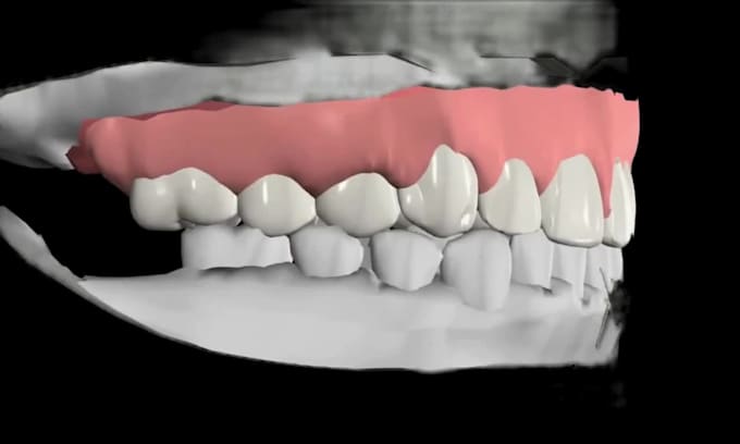 3d surgical dental medical animation anatomy animation 3d teeth surgery video