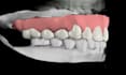 3d surgical dental medical animation anatomy animation 3d teeth surgery video
