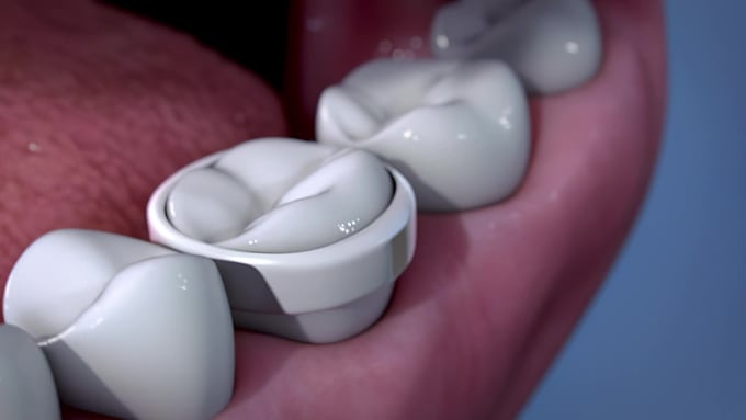 do 3d medical animation