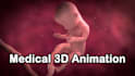 create medical 3d animation video
