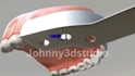 create 3d medical animation, dental implant and teeth surgery animation