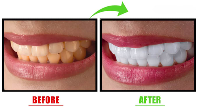 fix, whiten, and perfect your teeth smile in photoshop