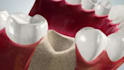 oral cgi 3d cgi medical animation 3d explainer video  high quality dental medica