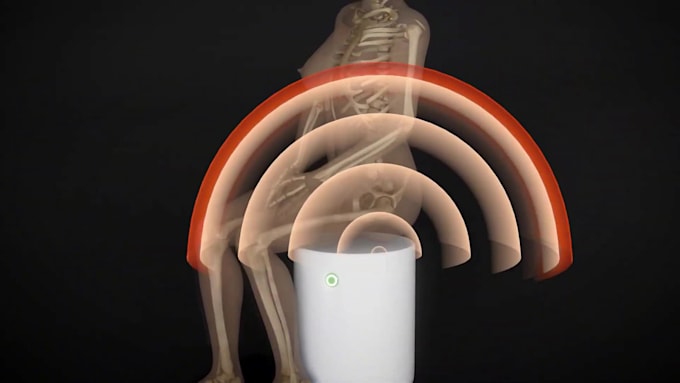 3d anatomy and surgery animation medical explainer video with visualization