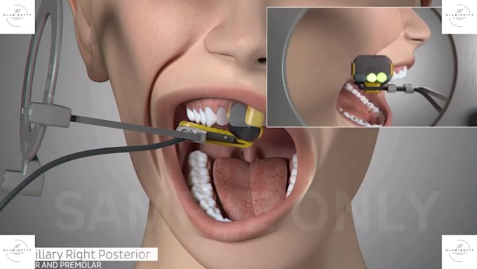 create stunning 3d dental video 3d medical animation for devices and  procedures