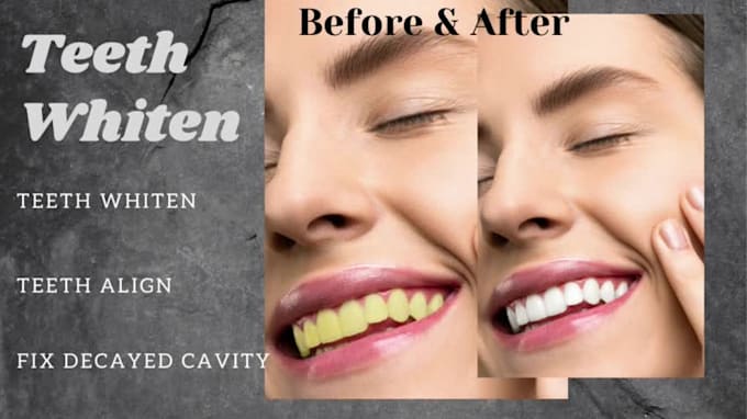 fix, adjust, whiten teeth in photoshop within 24 hours