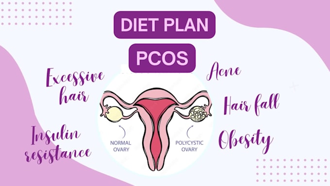be your nutritionist and make a diet plan for pcos