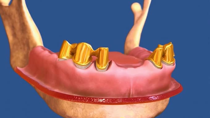 do animation videos for the dental waiting room