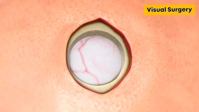 create aesthetic 3d medical animation, medical video with super quality