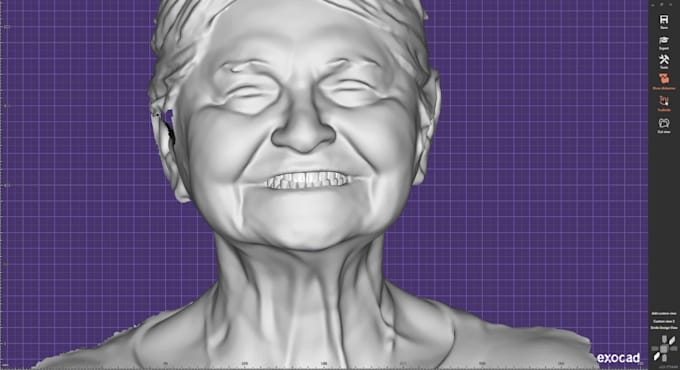Design custom implants, thimbles, bridges with exocad and blender by ...