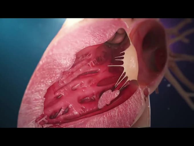 make 3d medical animation, 3d explainer medical videos, medical illustration