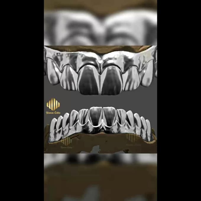 design a custom implant crown for your digital dental case