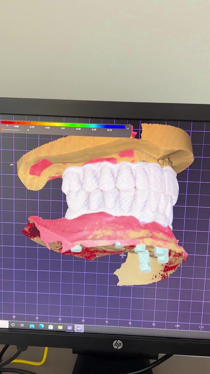 create dental artistry with exocad 3d