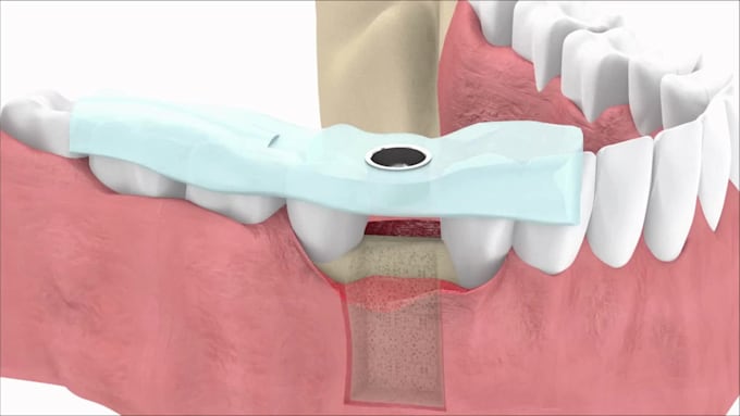 create stunning 3d dental animation, medical video, and procedure visual in HD