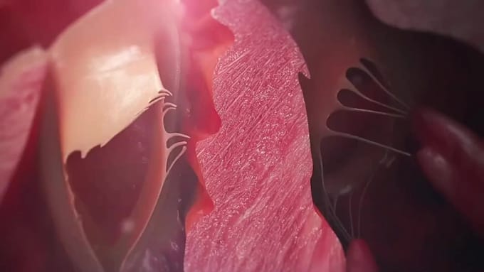 Create 3d medical animation, 3d biomedical animation, 3d surgery ...