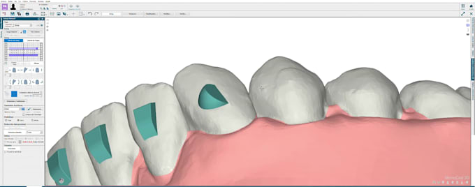 treatment planning service for clear aligners