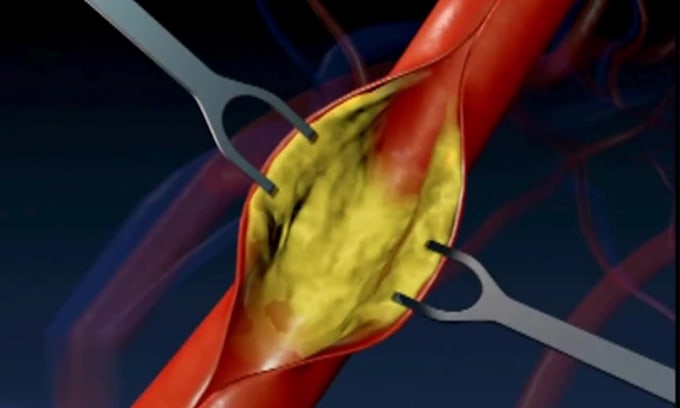 3d vfx medical animation dental animation 3d explainer video surgery animation